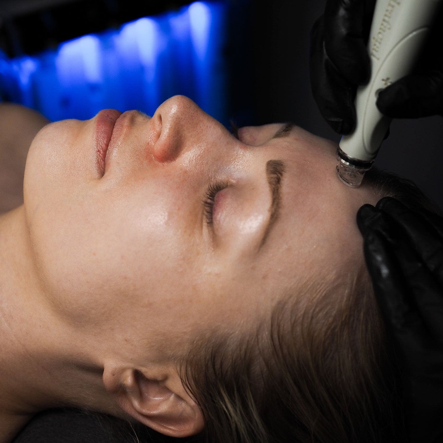 Hydrafacial™ Radiance | Liminka