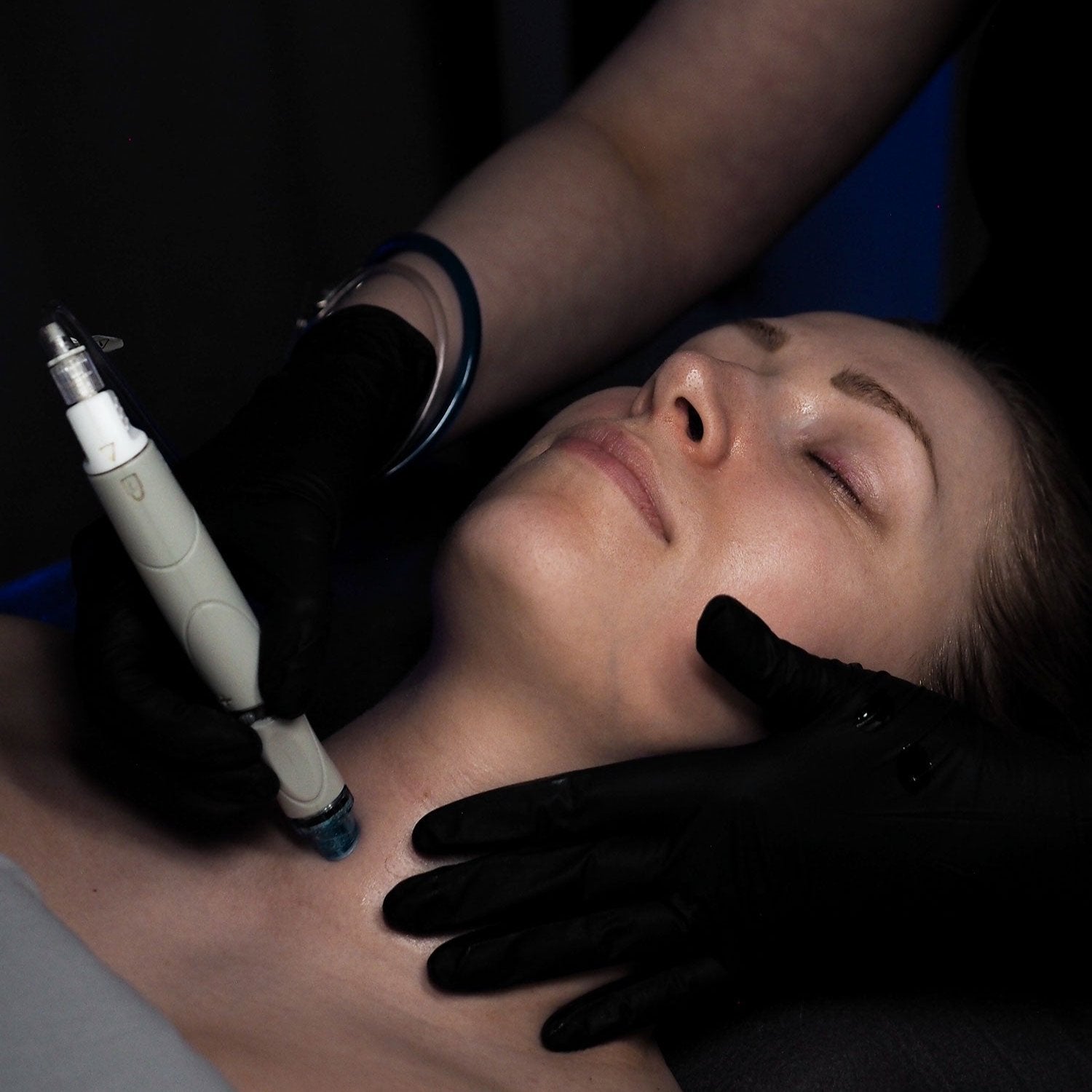 Hydrafacial™ Radiance | Liminka