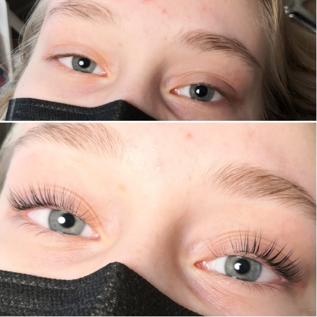 Lashlift